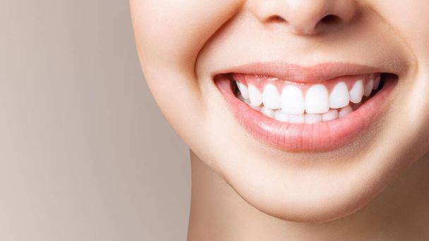 Sonrisa de dientes sanos perfectos de una mujer joven. Blanqueamiento dental. Paciente de la clínica dental. La imagen simboliza el cuidado bucal odontología, estomatología. Imagen de odontología
. - Foto, imagen