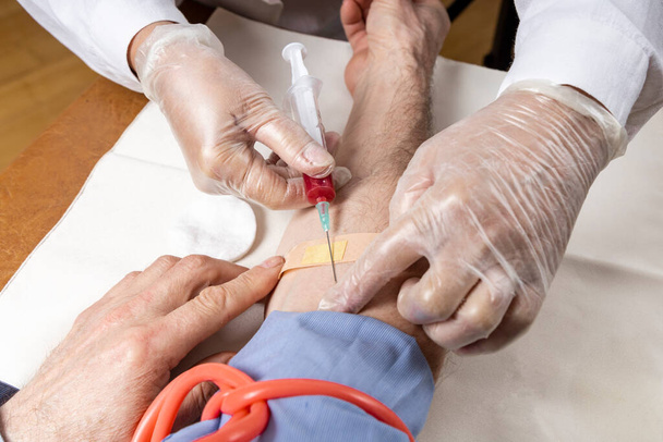 Handen van een verpleegster nemen bloed van een mannelijke hand voor analyse - Foto, afbeelding
