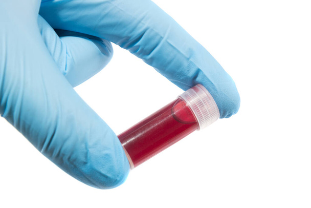 zkumavka s krevními testy v ruce, - Fotografie, Obrázek