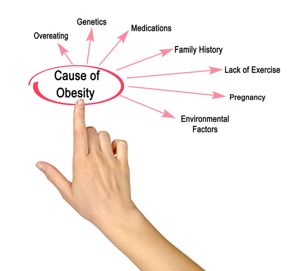 Yedi Obezite Sebebi Sunar - Fotoğraf, Görsel