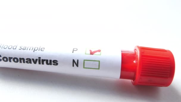Closeup of blood tube test.corona virus label - Záběry, video