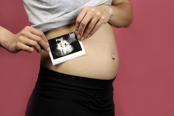 Terhes nőnél van egy kép az ultrahangjáról. - Fotó, kép