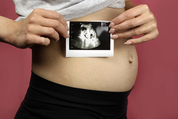 Terhes nőnél van egy kép az ultrahangjáról. - Fotó, kép