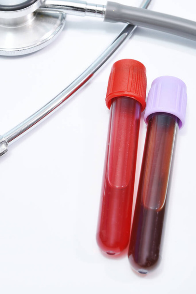 Blood test tube and stethoscope isolated on white background.  - Foto, afbeelding