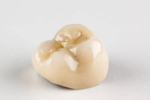 Metallkeramische Zahnkrone aus nächster Nähe auf weißem Hintergrund fotografiert - Foto, Bild