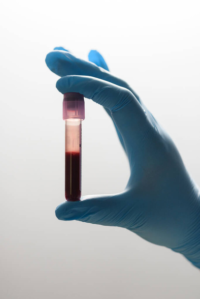 Manos del médico sosteniendo un tubo de ensayo con una muestra de sangre para la investigación
. - Foto, Imagen