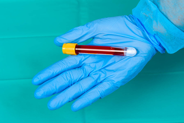 Tubo de ensayo de sujeción manual con plasma sanguíneo listo para análisis - Foto, imagen