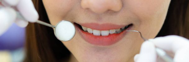 Баннер закрывает изображение женского рта, пока дантист чистит зубы. Концепция стоматологической клиники
 - Фото, изображение