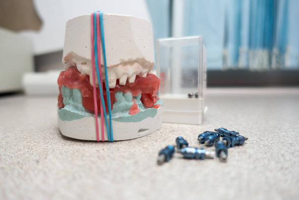 werkplek van een tandtechnicus voor de vervaardiging van tandprothesen op implantaten - Foto, afbeelding