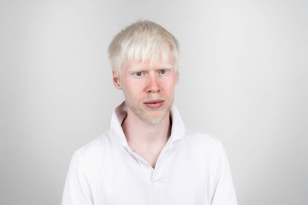 portrait of an albino man in  studio dressed t-shirt isolated on a white background. abnormal deviations. unusual appearance. skin abnormality - Valokuva, kuva