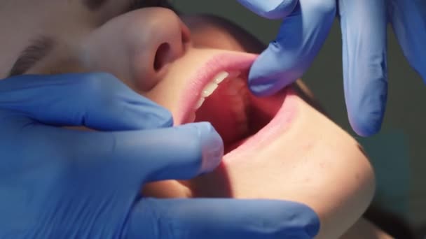 Dentist examining patients teeth - Кадры, видео