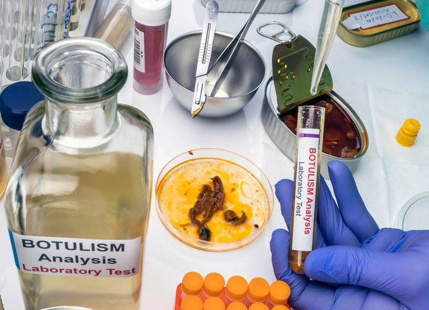 Deneyimli bir bilim adamı konserve yiyecek kutusundan alınan bir örneği analiz ediyor, hasta insanlarda botulizm enfeksiyonu, kavramsal görüntü... - Fotoğraf, Görsel