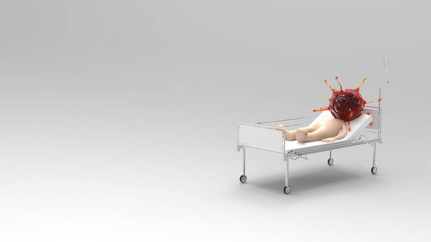 Koronavirus muž spát na lůžku pacienta v nemocnici, aby se před kýmkoli s 3D vykreslování. - Fotografie, Obrázek
