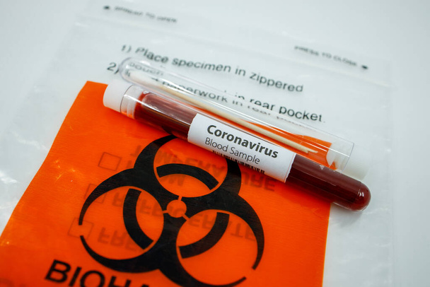 Primer plano de un resultado positivo de la prueba de sangre para coronavirus y hisopo de algodón para la prueba de COVID-19 en la parte superior de una bolsa de riesgo biológico. Concepto de prueba de kit pandémico covid19
. - Foto, Imagen