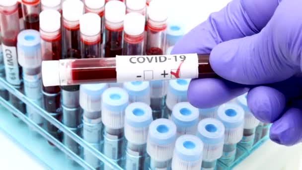 Close up of doctor hand with surgical gloves showing a positive blood test result for coronavirus and placing it on a test tubes rack. Test tubes rack with blood sample for covid-19 virus - Footage, Video