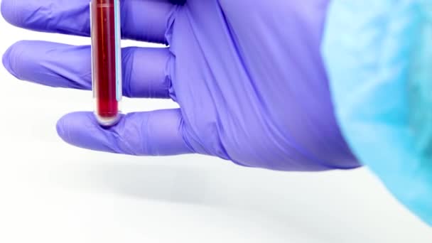 Gros plan de la main du microbiologiste ou du travailleur médical avec des gants chirurgicaux bleus marquant le résultat du test sanguin comme positif pour le nouveau coronavirus à propagation rapide. COVID-19 Concept positif - Séquence, vidéo