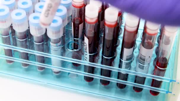 新しい急速に普及しているコロナウイルスのための肯定的な結果として、血液検査の結果をマーク青い外科手袋で微生物学者や医療従事者の手の閉鎖。COVID-19ポジティブコンセプト - 映像、動画