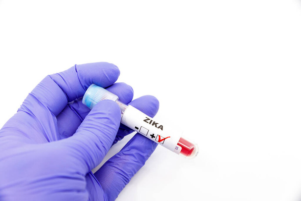 Κλείσιμο του χεριού του μικροβιολόγου ή του ιατρού με μπλε χειρουργικά γάντια που επισημαίνουν το αποτέλεσμα των αιματολογικών εξετάσεων ως θετικό για το zika. Zika Θετική έννοια - Φωτογραφία, εικόνα