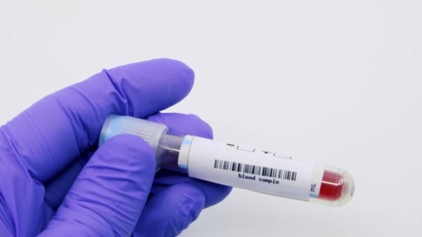 マイクロ生物学者や医療従事者の閉鎖は、糖尿病のための肯定的な結果として血液検査の結果をマーク青い外科手袋で手。糖尿病正の概念 - 映像、動画