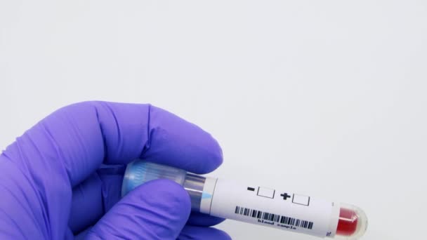 微生物学者や医療従事者の閉鎖は、エボラの陽性として血液検査の結果をマーク青い外科手袋で手.エボラ正の概念 - 映像、動画