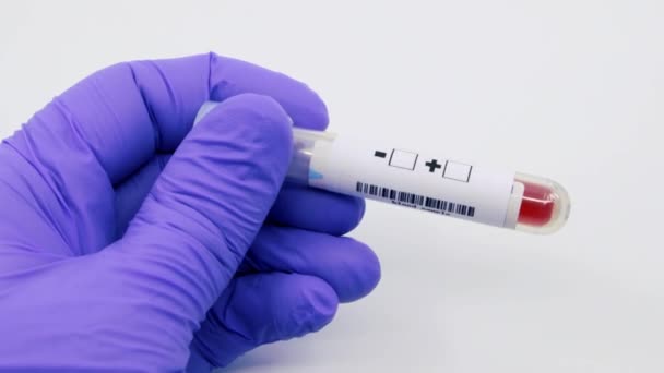 Closeup of microbiologist or medical worker hand with blue surgical gloves marking blood test result as positive for the gout. Gout Positive concept - Footage, Video