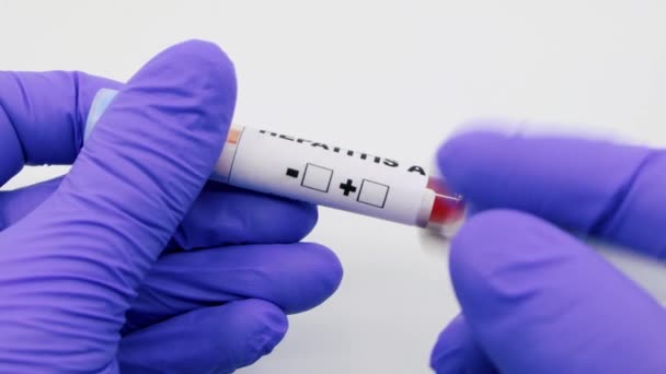Closeup of microbiologist or medical worker hand with blue surgical gloves marking blood test result as positive for the hepatitis A. Hepatitis A Positive concept - Footage, Video