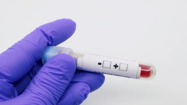Gros plan de la main d'un microbiologiste ou d'un travailleur médical portant des gants chirurgicaux bleus indiquant que le résultat du test sanguin est positif pour l'hépatite B. Hépatite B Concept positif
 - Séquence, vidéo