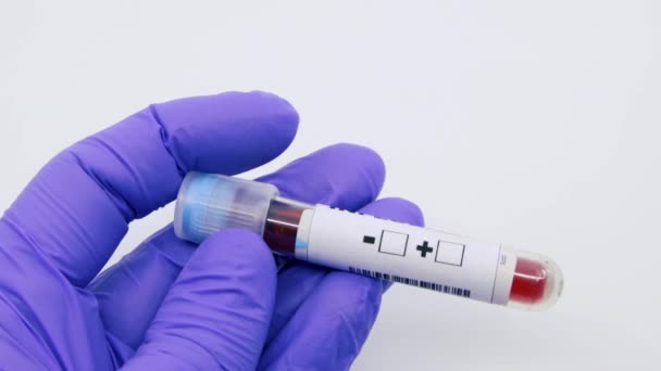 マイクロ生物学者や医療従事者の手の閉鎖は、インフルエンザの陽性として血液検査の結果をマーク青い外科手袋で。インフルエンザ陽性概念 - 映像、動画