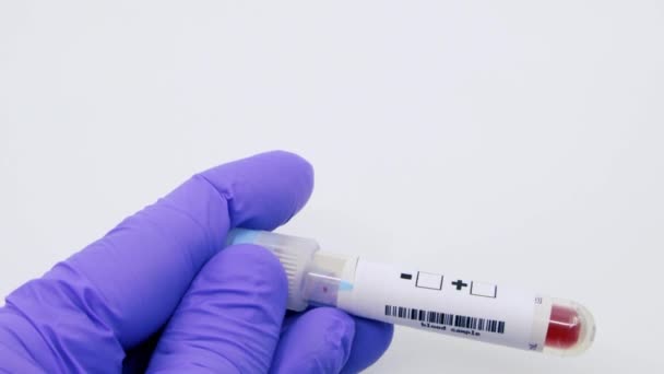 Gros plan de la main d'un microbiologiste ou d'un travailleur médical portant des gants chirurgicaux bleus indiquant que le résultat du test sanguin est positif pour l'hépatite C. Hépatite C Concept positif
 - Séquence, vidéo
