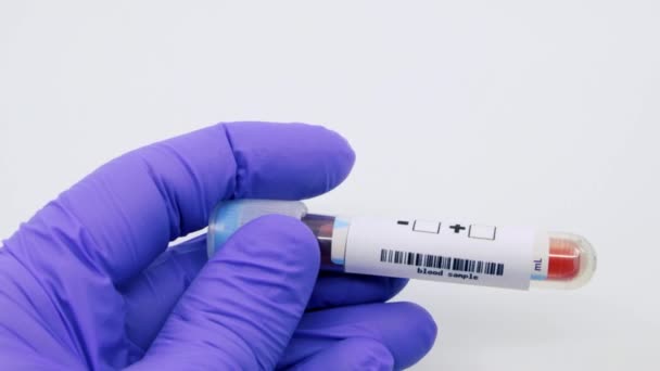 Closeup van microbioloog of medisch medewerker hand met blauwe chirurgische handschoenen markeren bloedonderzoek resultaat als positief voor de polio. Polio Positief concept - Video