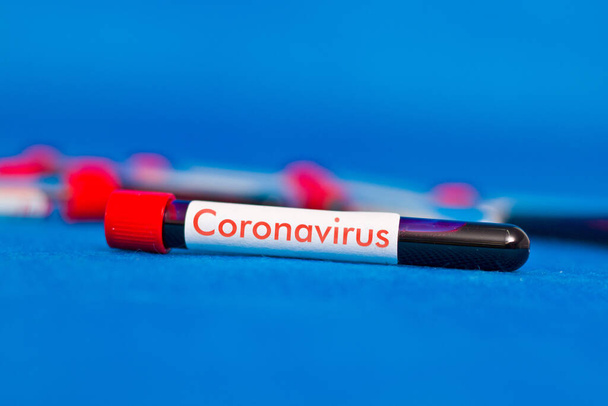 Bloedreageerbuis close-up met de inscriptie coronavirus. - Foto, afbeelding