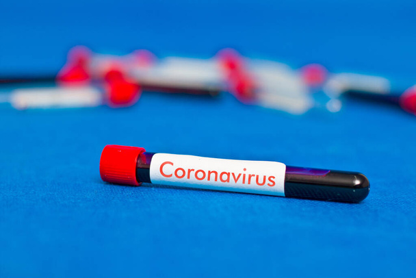 Трубка для анализа крови крупным планом с надписью коронавирус
. - Фото, изображение