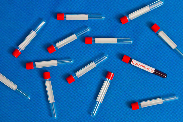 Σωλήνας αίματος και κενή ετικέτα για το κενό, μεταξύ άλλων κενών σωλήνων. Με την επιγραφή coronavirus. - Φωτογραφία, εικόνα