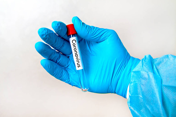 Mão em azul luvas de borracha descartáveis médicos segurando um tubo de teste em branco para coletar análises em um fundo cinza com a inscrição coronavírus
 - Foto, Imagem