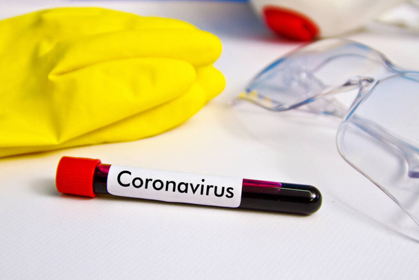 Blutprobe auf dem Hintergrund von Gummihandschuhen und Brille auf dem Tisch. Die Probe liegt auf dem Tisch mit der Aufschrift Coronavirus - Foto, Bild