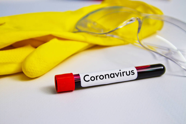 Blood sample on the background of rubber gloves and glasses on the table. The sample is on the table with the inscription coronavirus - Photo, Image