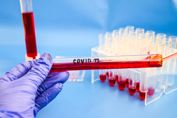 Campione di sangue di coronavirus, test del DNA del sangue in laboratorio e tubi di raccolta del campione di sangue e siringa con interfaccia moderna del DNA sfondo blu, virus covid-19
 - Foto, immagini