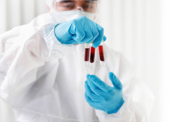 Researchers compare blood samples of patients infected with the disease in the laboratory. Researchers are inventing vaccines to treat COVID-19 virus. - Фото, изображение