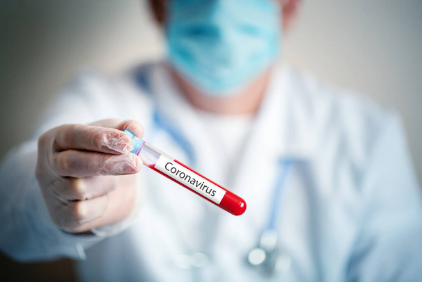 The epidemic of coronavirus. The doctor keeps a blood test. - Φωτογραφία, εικόνα