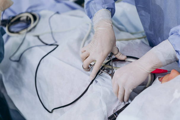  Medical team of surgeons in hospital doing minimal invasive surgical interventions. Surgery operating room with electrocautery equipment for cardiovascular emergency surgery center, selective focus - Foto, Imagen