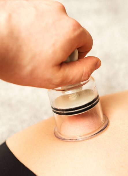Massage anti-cellulite avec un bocal à vide. Procédure médicale
. - Photo, image