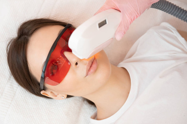 Laserentfernung Haare unerwünscht auf Gesicht junge Frau. Gesundheits- und Schönheitskonzept - Foto, Bild