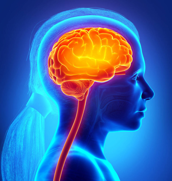 3D gerenderte, medizinisch korrekte Illustration eines jungen Mädchens hervorgehoben Gehirn / Kopfschmerzen - Foto, Bild