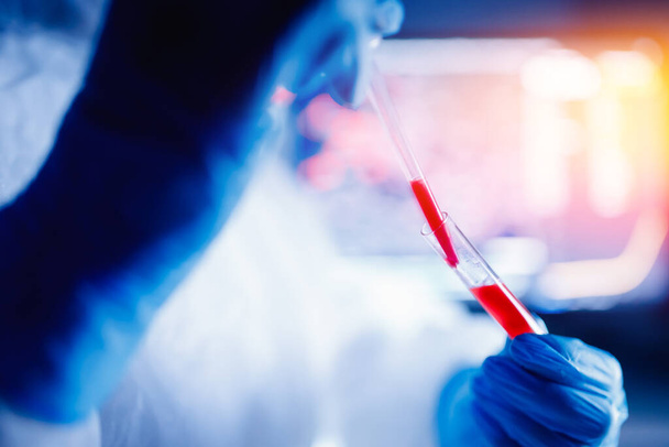 Pielęgniarka biologiczne zagrożenie gospodarstwa badania krwi dodatni koronawirus w laboratorium zdrowia - Zdjęcie, obraz