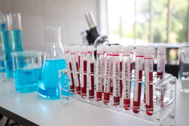 Зосередьмо один зразок крові в трубці. Close-Up on Covid 19 кров'яна трубка для дослідження вакцини в лабораторії на тлі наукової лабораторії. - Фото, зображення
