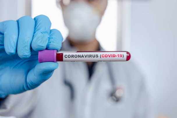 Tests de laboratoire sur des patients échantillons de sang pour détecter la présence de coronavirus (COVID) Le médecin détient une éprouvette contenant un échantillon de sang qui n'a pas le résultat positif ou négatif pour le coronavirus
. - Photo, image
