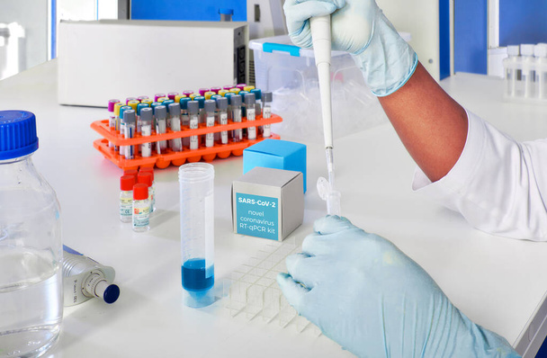 Laboratuvar içi, test laboratuvarı, viral zatürree olan hastalardan alınan kan örnekleri SARS-CoV-2 ve grip virüsleri için nükleik asitler ve virüslere karşı özel antikorlar için test edilecek.. - Fotoğraf, Görsel