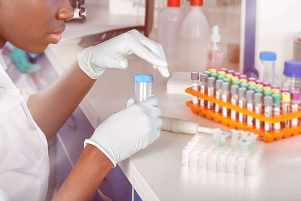 Γυναίκες ειδικοί, επαγγελματίες κάνουν τεστ νουκλεϊνικού οξέος για rna του νέου ιού της κορώνας SARS-CoV-2. - Φωτογραφία, εικόνα