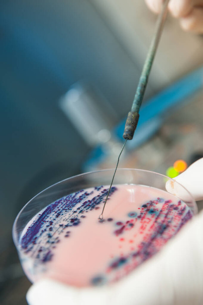 coltivazione di batteri virali in un laboratorio scientifico
  - Foto, immagini