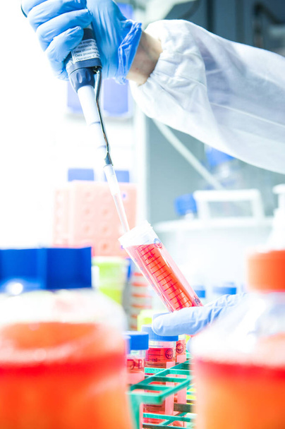 επιστήμονας που αναλύει τον ιό στο εργαστήριο covid 19 αίμα και χημικό σωλήνα αντιδραστηρίου στο χέρι έρευνα εμβόλιο coronavirus  - Φωτογραφία, εικόνα